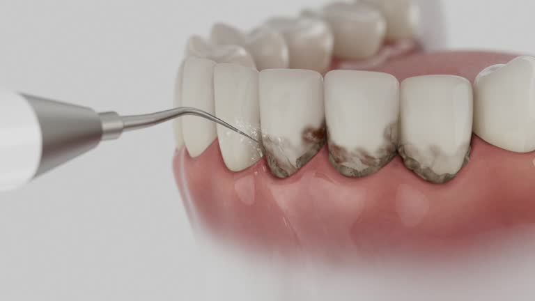Reliable Dental contractor in Ledgewood, NJ by Dentist Open Now